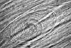 Trichinella